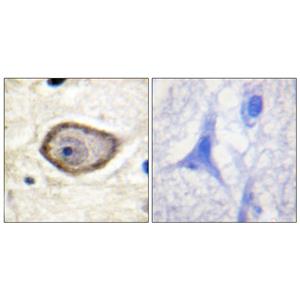 TF (phospho Ser290)兔多抗,TF (phospho Ser290) Rabbit Polyclonal Antibody