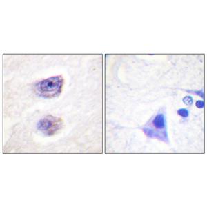 TH (phospho Ser8)兔多抗,TH (phospho Ser8) Rabbit Polyclonal Antibody