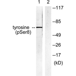 TH (phospho Ser8)兔多抗,TH (phospho Ser8) Rabbit Polyclonal Antibody