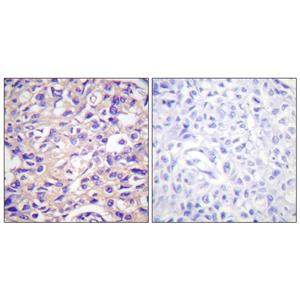 Thymidine Kinase (phospho Ser13)兔多抗,Thymidine Kinase (phospho Ser13) Rabbit Polyclonal Antibody