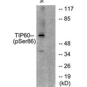TIP60 (phospho Ser86)兔多抗,TIP60 (phospho Ser86) Rabbit Polyclonal Antibody