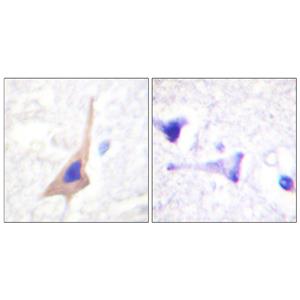TPH1 (phospho Ser58)兔多抗,TPH1 (phospho Ser58) Rabbit Polyclonal Antibody