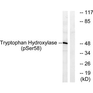 TPH1 (phospho Ser58)兔多抗,TPH1 (phospho Ser58) Rabbit Polyclonal Antibody