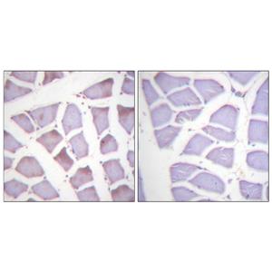 XIAP (phospho Ser87)兔多抗,XIAP (phospho Ser87) Rabbit Polyclonal Antibody