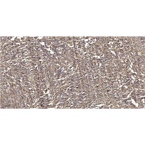 GRK2 (Phospho-Tyr86)兔多抗,GRK2 (Phospho-Tyr86) Rabbit Polyclonal Antibody