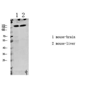 LATS1/2 (Phospho-Thr1079/1041)兔多抗,LATS1/2 (Phospho-Thr1079/1041) Rabbit Polyclonal Antibody