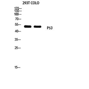 p53 (Mono Methyl Lys370)兔多抗,p53 (Mono Methyl Lys370) Rabbit Polyclonal Antibody