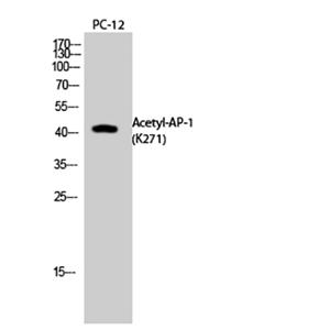 AP-1 (Acetyl Lys271)兔多抗,AP-1 (Acetyl Lys271) Rabbit Polyclonal Antibody