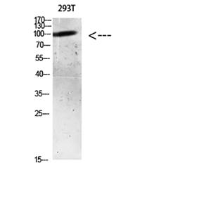 AR (Acetyl Lys633)兔多抗,AR (Acetyl Lys633) Rabbit Polyclonal Antibody