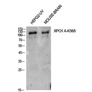 CRM1 (Acetyl Lys568)兔多抗,CRM1 (Acetyl Lys568) Rabbit Polyclonal Antibody