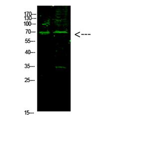 E2F-1 (Acetyl-K117)兔多抗,E2F-1 (Acetyl-K117) Rabbit Polyclonal Antibody