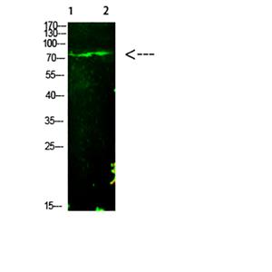 E2F-1 (Acetyl-K125)兔多抗,E2F-1 (Acetyl-K125) Rabbit Polyclonal Antibody