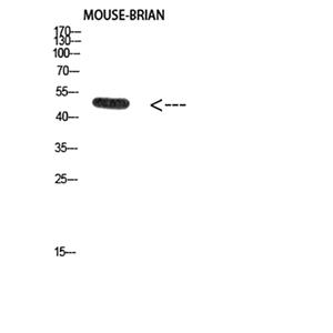 E2F-1 (Acetyl-Lys120)兔多抗,E2F-1 (Acetyl-Lys120) Rabbit Polyclonal Antibody