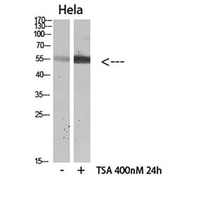 HNF-4α (Acetyl Lys106)兔多抗,HNF-4α (Acetyl Lys106) Rabbit Polyclonal Antibody