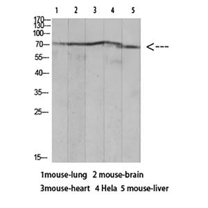 Ku-70 (Acetyl Lys317)兔多抗,Ku-70 (Acetyl Lys317) Rabbit Polyclonal Antibody
