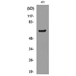 Ku-70 (Acetyl Lys331)兔多抗,Ku-70 (Acetyl Lys331) Rabbit Polyclonal Antibody