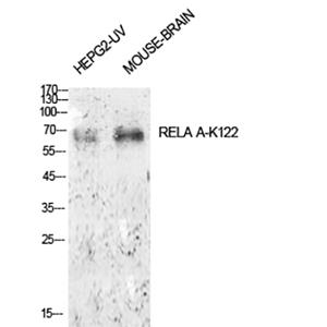 NFκB-p65 (Acetyl Lys122)兔多抗,NFκB-p65 (Acetyl Lys122) Rabbit Polyclonal Antibody
