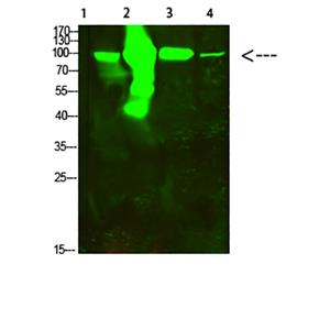 ACO2兔多抗,ACO2 Rabbit Polyclonal Antibody