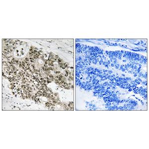 ATR兔多抗,ATR Rabbit Polyclonal Antibody