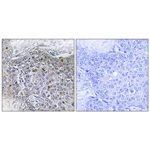 BS69兔多抗,BS69 Rabbit Polyclonal Antibody