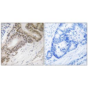 FoxO3A兔多抗,FoxO3A Rabbit Polyclonal Antibody