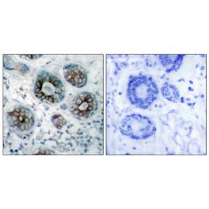 GAP-43兔多抗,GAP-43 Rabbit Polyclonal Antibody