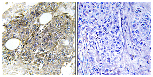TGFβ RIII兔多抗,TGFβ RIII Rabbit Polyclonal Antibody