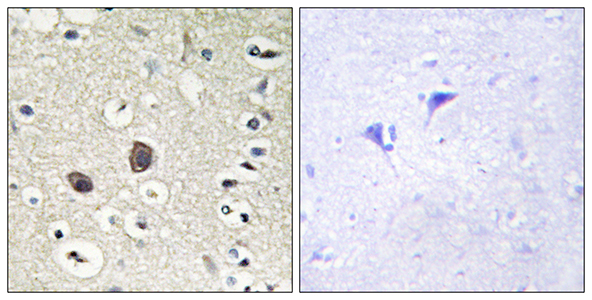 Tie-2兔多抗,Tie-2 Rabbit Polyclonal Antibody