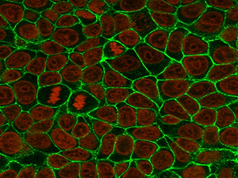 Dilinoleyl DiI（细胞膜橙红色荧光探针）,Dilinoleyl DiI Membrane Probe (Orange-Red)