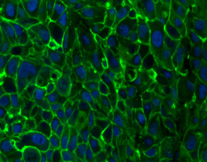 DiO（细胞膜绿色荧光探针）,DiO Membrane Probe (Green)