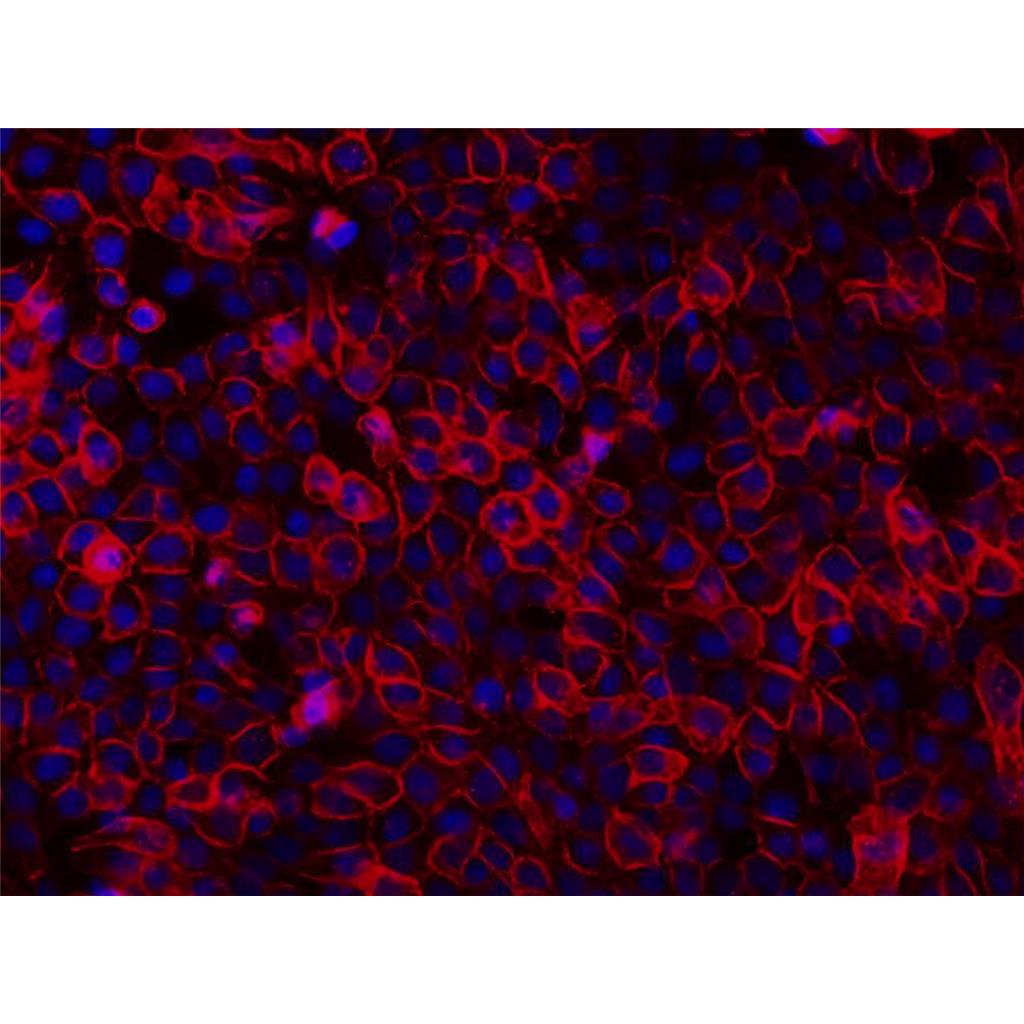DiR（细胞膜近红外荧光探针）,DiR Membrane Probe (Near-Infrared)