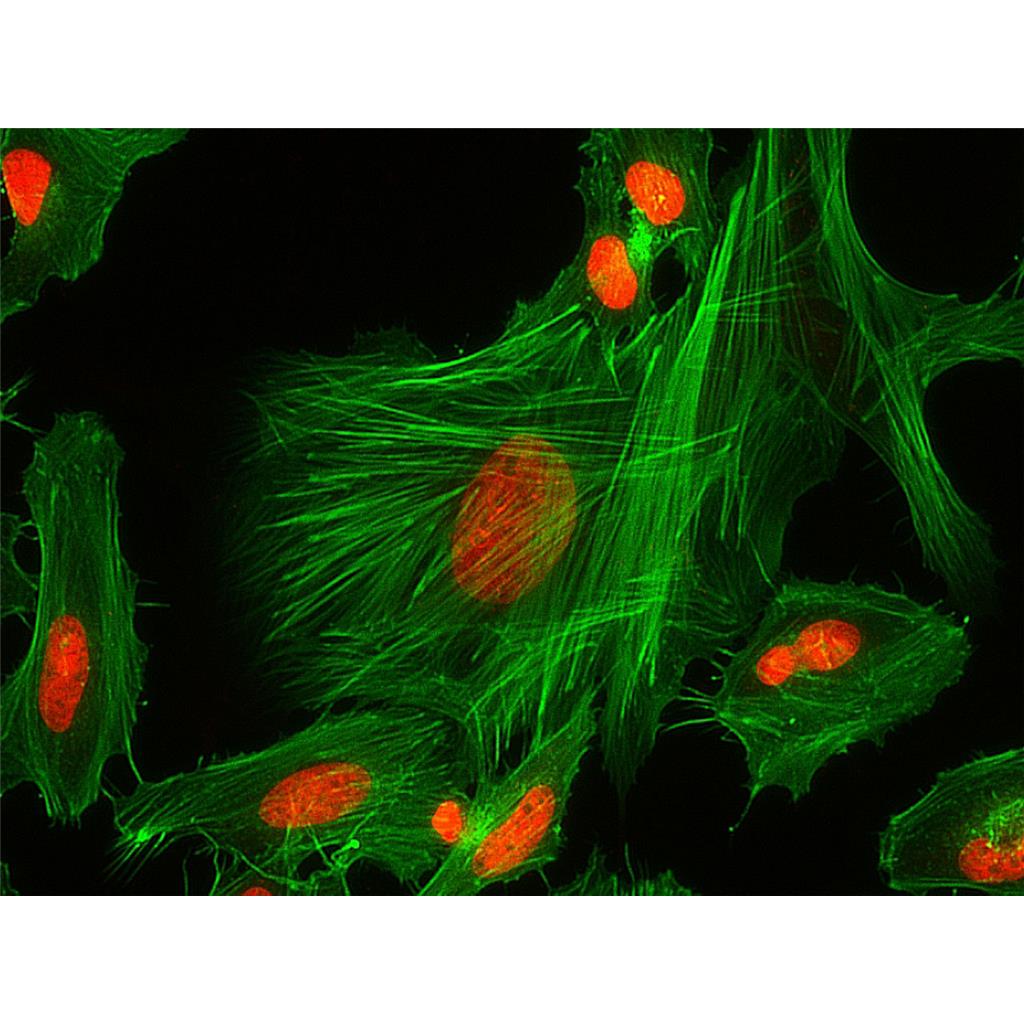 Fluorescein 488-Phalloidin（荧光素488标记鬼笔环肽）,Fluorescein 488-Phalloidin