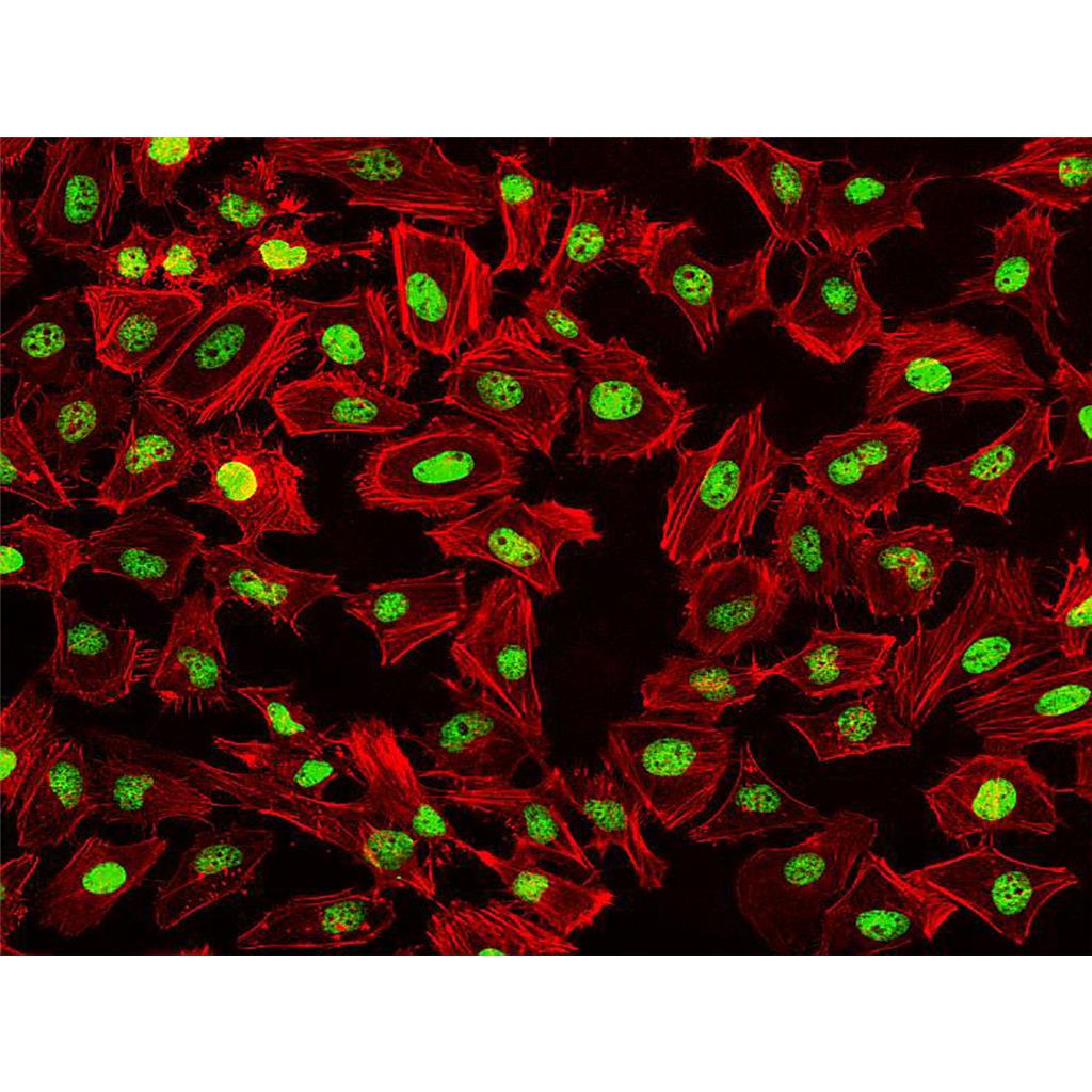 Fluorescein 555-Phalloidin（荧光素555标记鬼笔环肽）,Fluorescein 555-Phalloidin