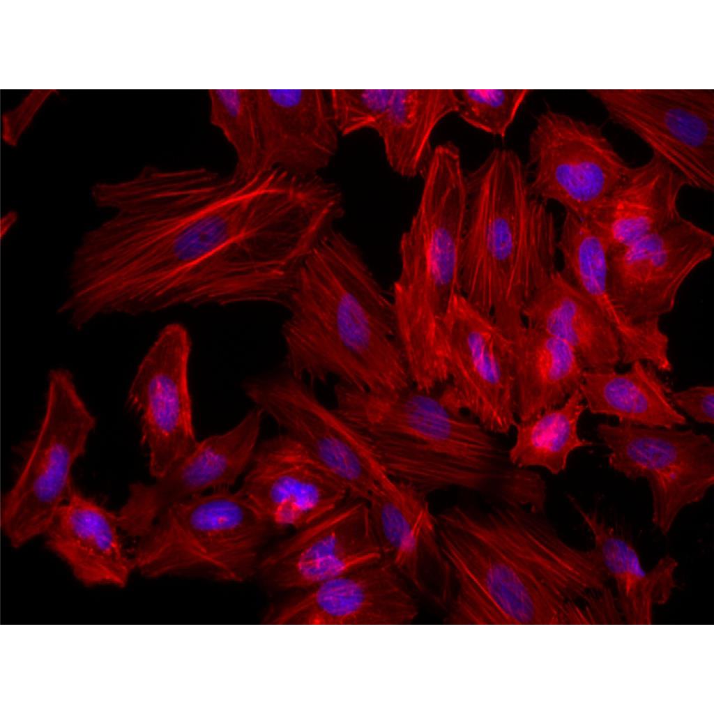 Fluorescein 594-Phalloidin（荧光素594标记鬼笔环肽）,Fluorescein 594-Phalloidin