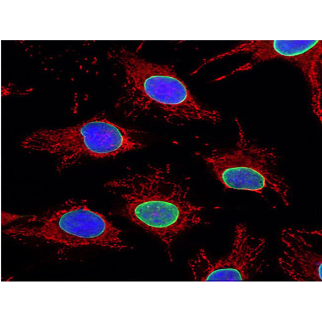 Mitochondrial Tracker (Red)（线粒体红色荧光探针）,Mitochondrial Tracker (Red)