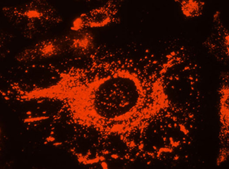 Lysosome Tracker (DeepRed)（溶酶体深红色荧光探针）,Lysosome Tracker (DeepRed)