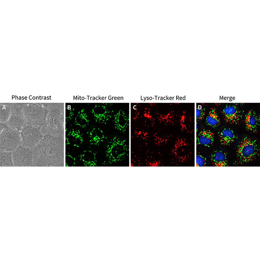 Lysosome Tracker (Red)（溶酶体红色荧光探针）,Lysosome Tracker (Red)