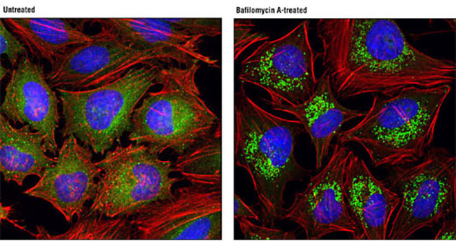 Lysosome Tracker (Green)（溶酶体绿色荧光探针）,Lysosome Tracker (Green)