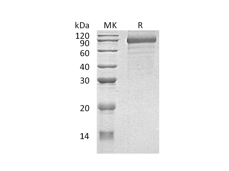 重组人CDH8 (C-6His)蛋白,Recombinant Human CDH8 (C-6His)