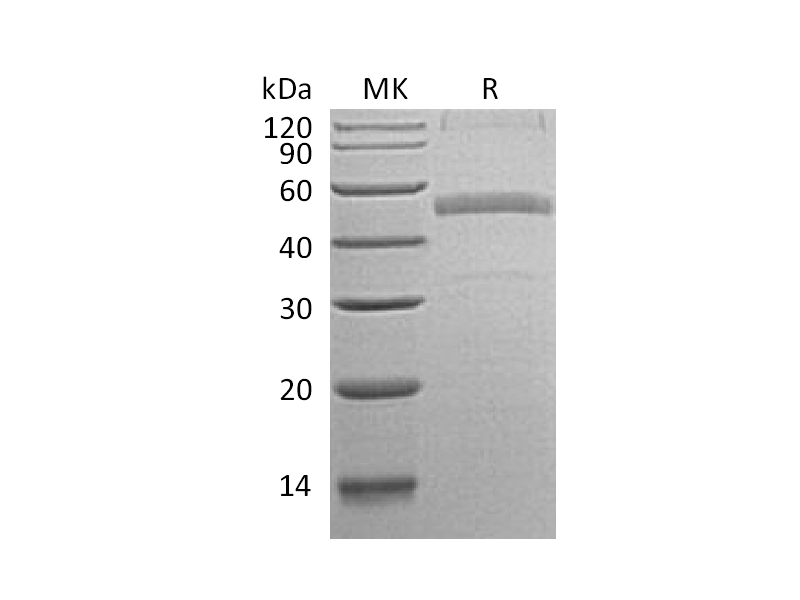 重组人Calumenin (C-6His)蛋白,Recombinant Human Calumenin (C-6His)