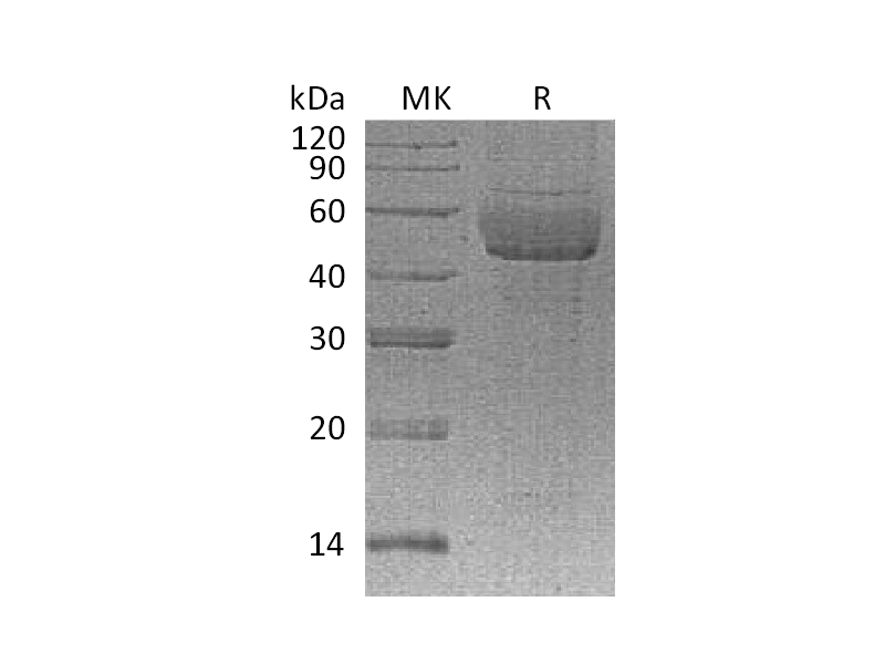 重组人SDC1 (C-6His)蛋白,Recombinant Human SDC1 (C-6His)