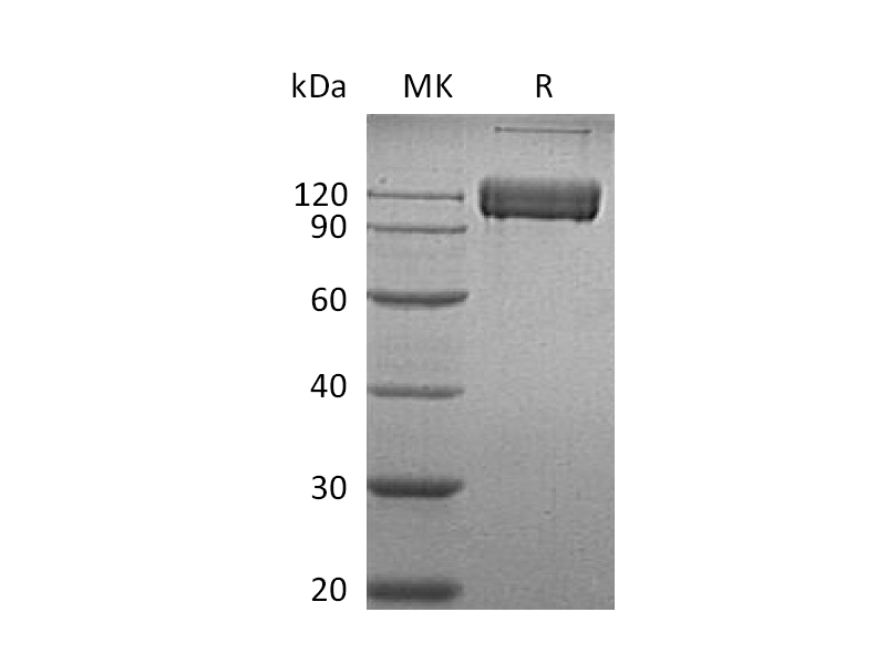 重组人ALCAM (C-Fc)蛋白,Recombinant Human ALCAM (C-Fc)
