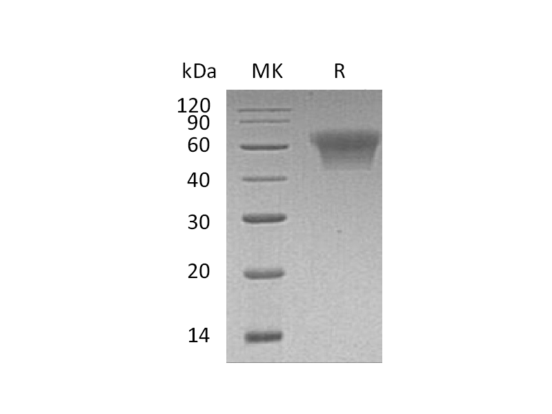 重组人CD55 (C-6His)蛋白,Recombinant Human CD55 (C-6His)