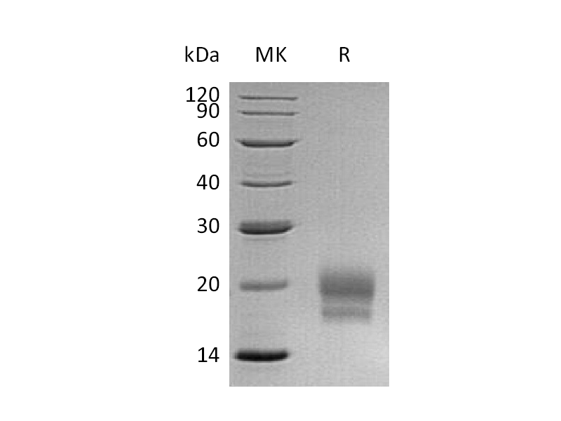 重组人CEACAM3 (C-6His)蛋白,Recombinant Human CEACAM3 (C-6His)