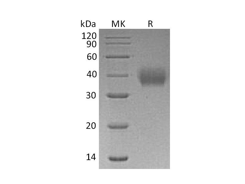 重组人FcAR (C-6His)蛋白,Recombinant Human FcAR (C-6His)