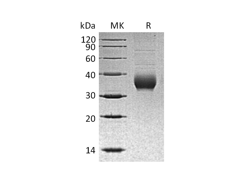重组人CHRNB3 (C-6His)蛋白,Recombinant Human CHRNB3 (C-6His)