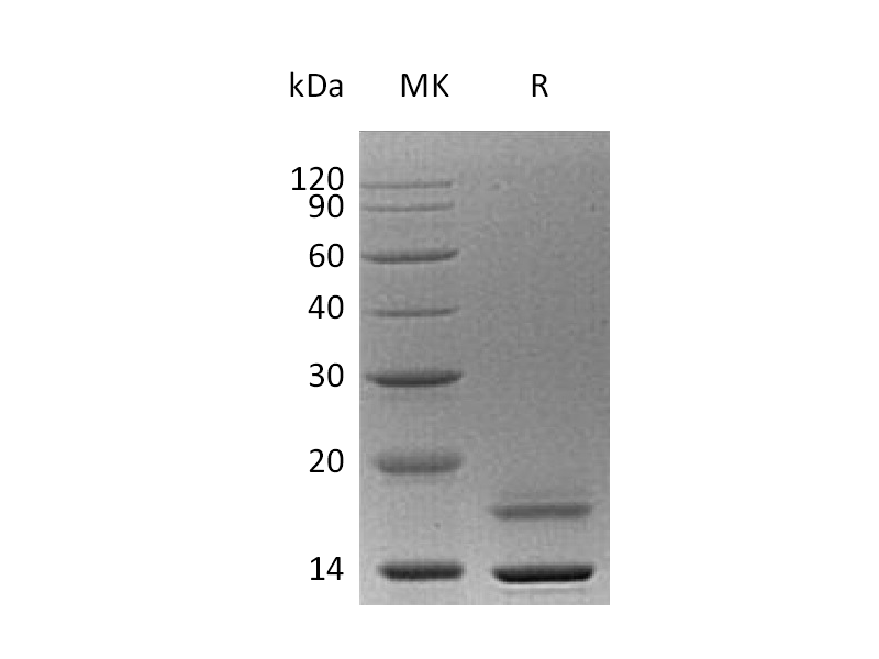 重组人CST6 (C-6His)蛋白,Recombinant Human CST6 (C-6His)