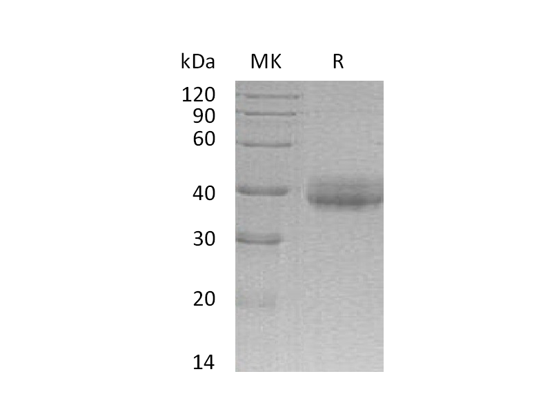 重组人CRELD2 (C-6His)蛋白,Recombinant Human CRELD2 (C-6His)