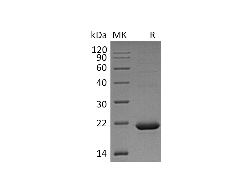 重组人CYB5B (C-6His)蛋白,Recombinant Human CYB5B (C-6His)