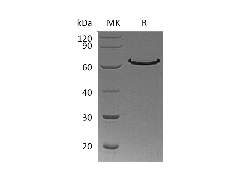 重组人DLL1 (C-6His)蛋白,Recombinant Human DLL1 (C-6His)